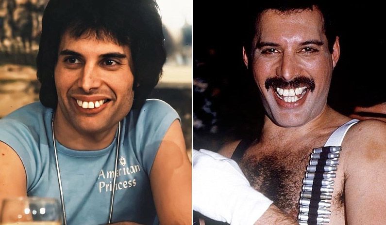 Freddie mercury's teeth