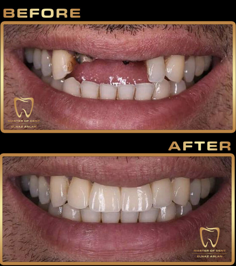 Dental work in turkey