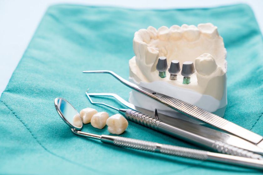 Teeth Implants in Turkey