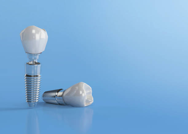 Are Dental Implants in Turkey Expensive?