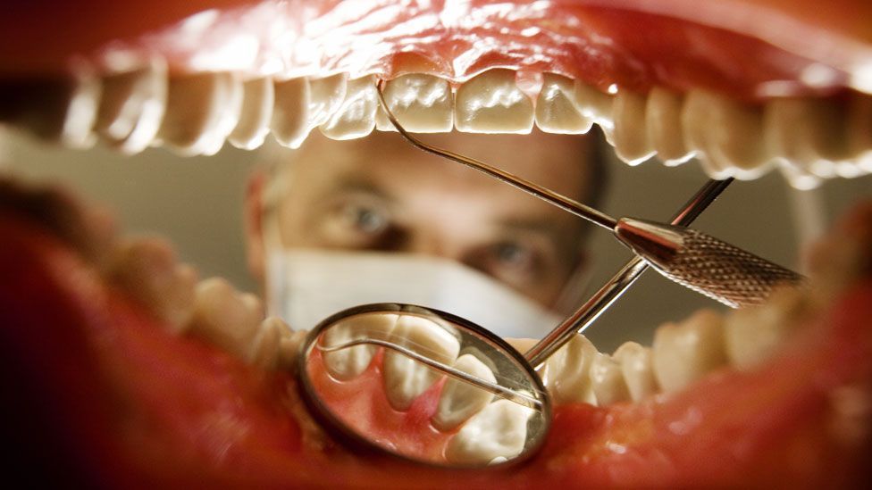 Preventing Dental Cavities